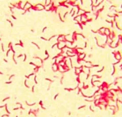 Окраска по Граму. Красные вибрионы