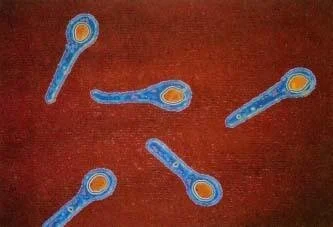 Споры возбудителя столбняка, окрашенные в красный цвет