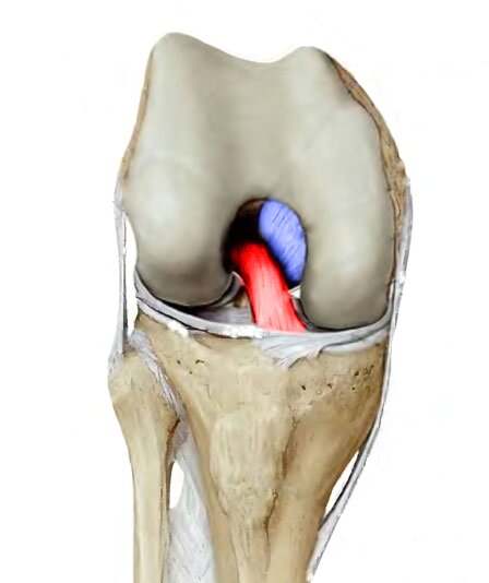 Передняя (красная) и задняя (синяя) крестообразные связки коленного сустава.