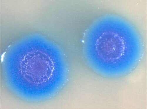 Колонии <em>Mycoplasma labora</em><em>torium</em>
