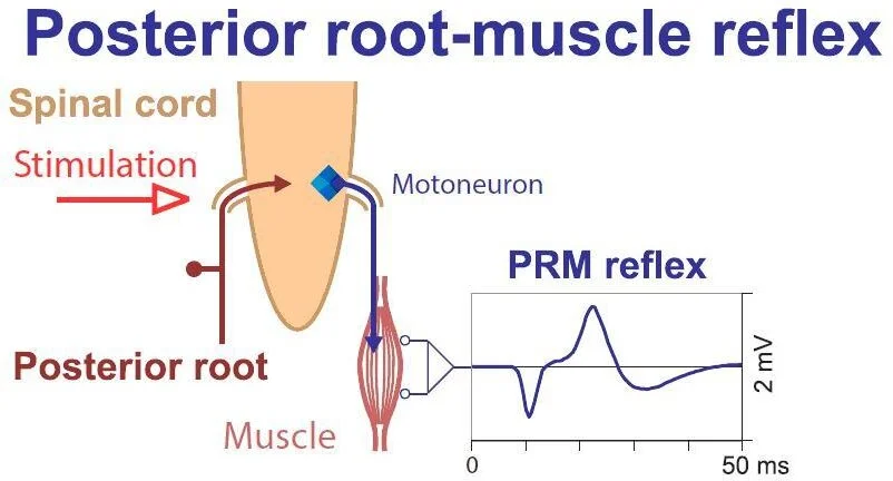 Вызов PRM рефлекса