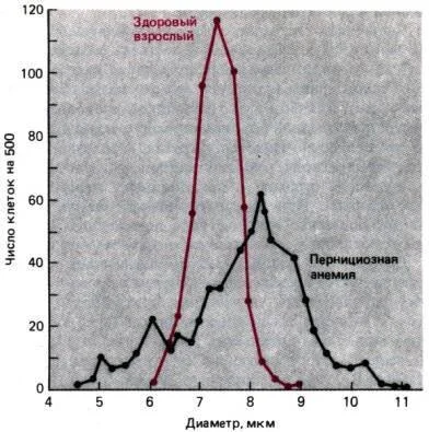Кривая Прайс-Джонса. Распределение диаметров эритроцитов у здорового человека (красная линия) и у больного пернициозной анемией (черная линия) (C. Price-Jones, 1910)