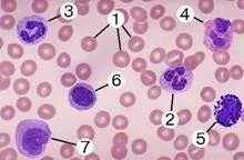 Клетки периферической крови: 1 - эритроциты; 2 - сегментоядерный нейтрофил; 3 - палочкоядерный нейтрофил; 4 - эозинофил; 5 - базофил; 6 - лимфоцит; 7 - моноцит.